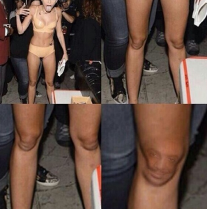Cyrus' knee resembles Alfonso Ribeiro